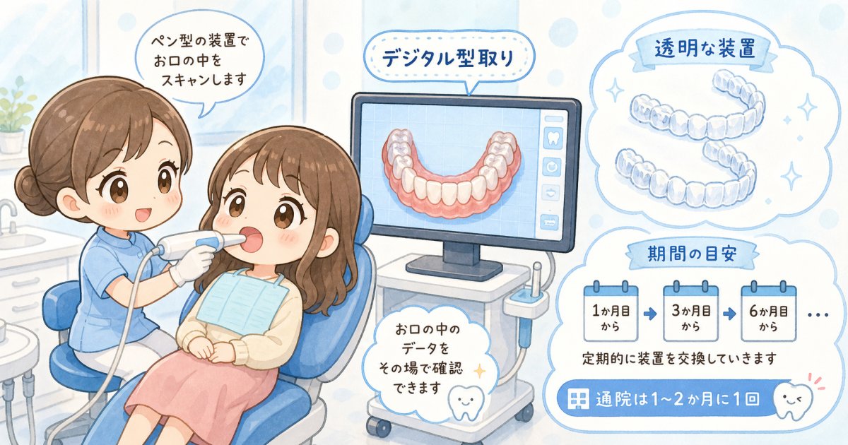 目立たず両立しやすいマウスピース治療の種類と期間目安